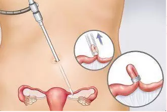 重慶送子鳥醫院