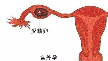 重慶送子鳥醫院