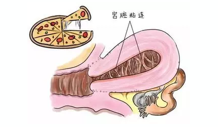 重慶送子鳥醫院