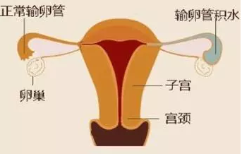 重慶送子鳥醫院