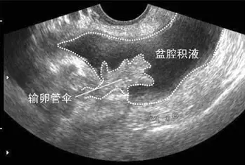 重慶送子鳥醫院